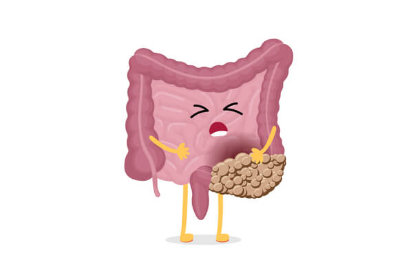Mucoid Plaque is Colon Waste Buildup